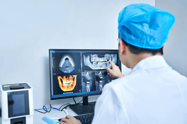 Best Emergency Wisdom Tooth Extraction in Fairwood, MD